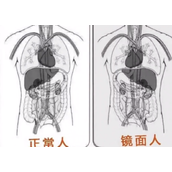 女子就医发现五脏六腑全长反 医生科普：镜面人 医学上无科学定论！