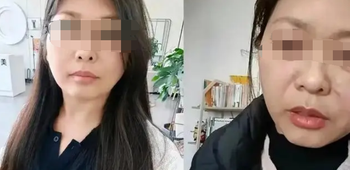 42岁女子20天断崖式衰老 前后判若两人！