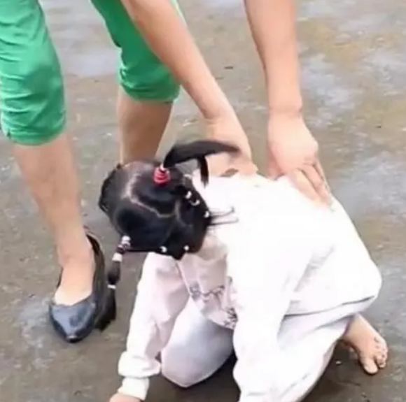 网红袖珍女孩疑遭母亲虐待 残联回应来了！