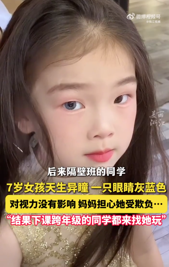 7岁异瞳女孩在学校受到同学喜爱 网友：妥妥小说女主角