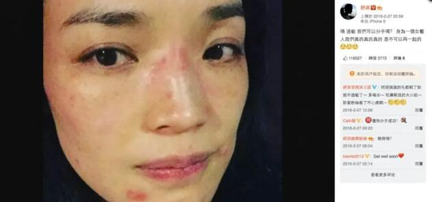舒淇称被传染病毒 呼吁大家生病要戴口罩
