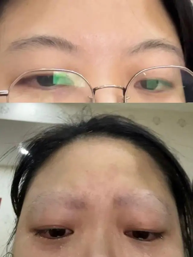 女子被鹦鹉啄光眉毛：以为在按摩 网友：修眉大师