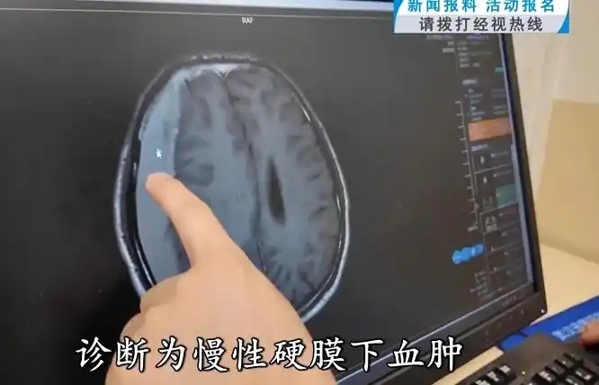 37岁男子连坐2次过山车致颅内出血 医院进行急诊手术