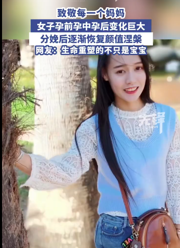 女子分享孕期分娩后容貌变化 网友：妈妈辛苦了