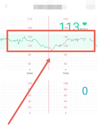 微胎心app胎心监护查看方法