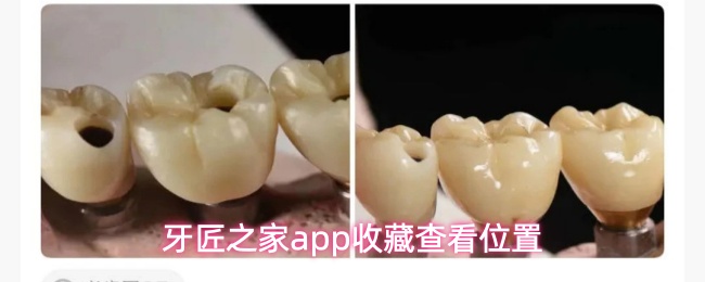 牙匠之家app收藏查看位置