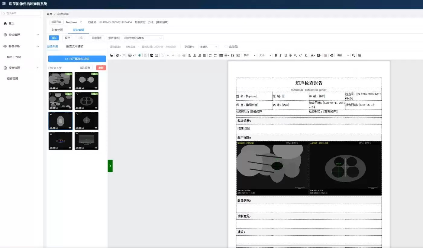 Java超声工作站:病理工作站影像诊断系统