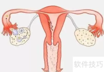 冻胚移植适合的人群有哪些